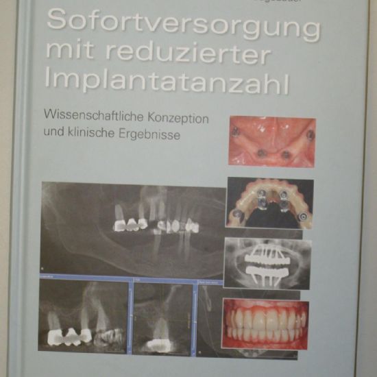 Kniha - Náhrady s redukovaným počtem implantátů