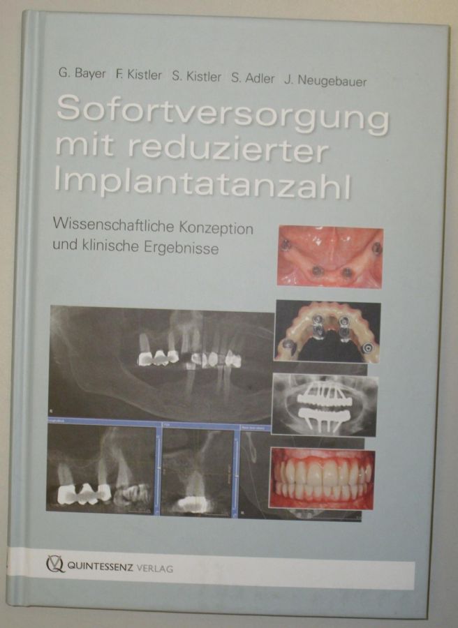 Kniha - Náhrady s redukovaným počtem implantátů